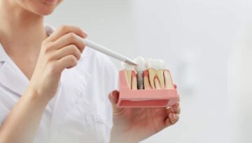 Dental-Implant-Caledonia-Revolutionizing-Dental-Solutions