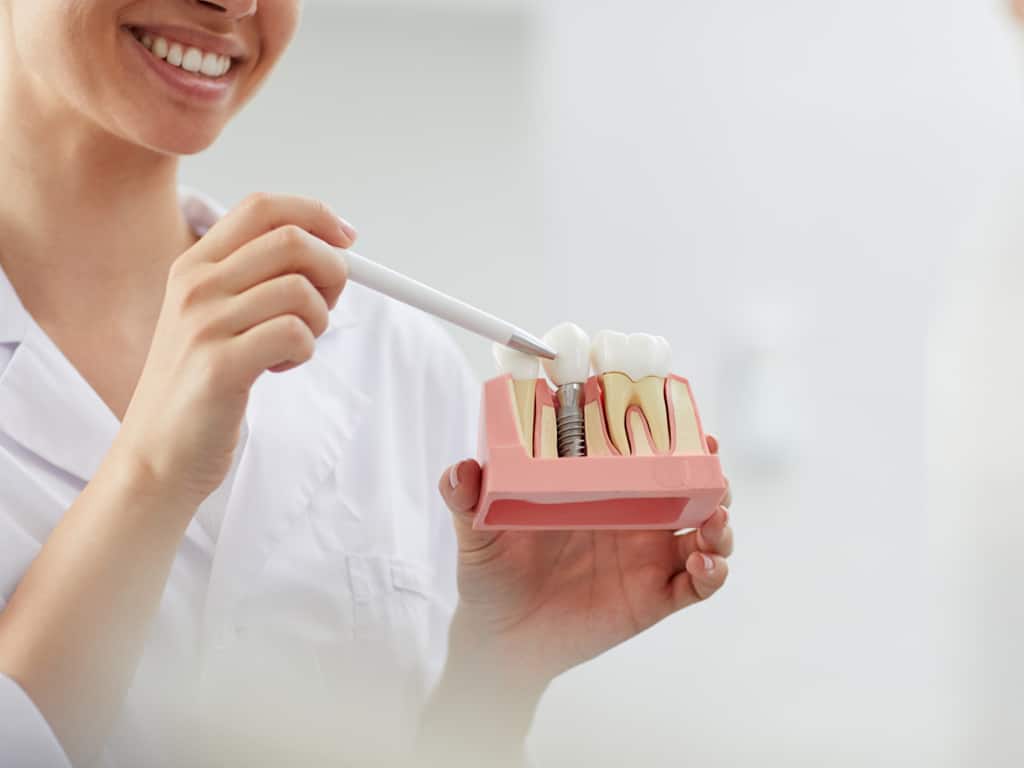 Dental-Implant-Caledonia-Revolutionizing-Dental-Solutions