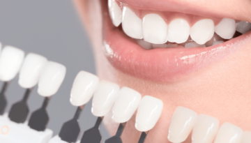 Teeth-whitening