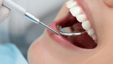 Restoring Fractured Teeth Bonding, Crowns, and Emergency Solutions at Dentistry At the Plex
