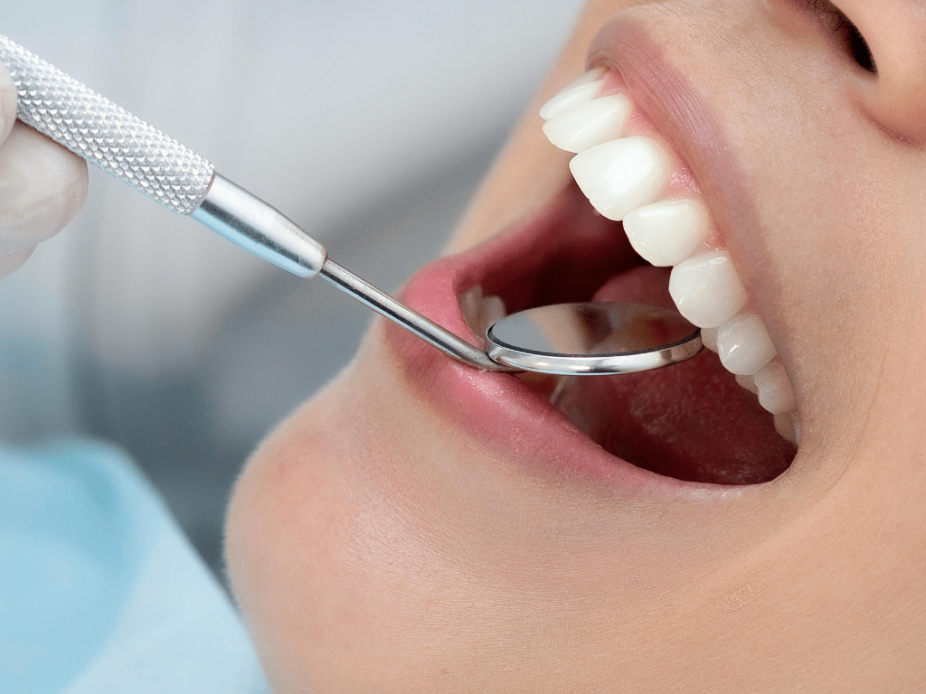 Restoring Fractured Teeth Bonding, Crowns, and Emergency Solutions at Dentistry At the Plex