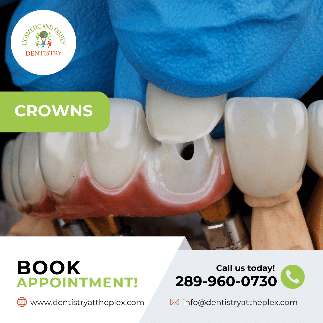 Crowns