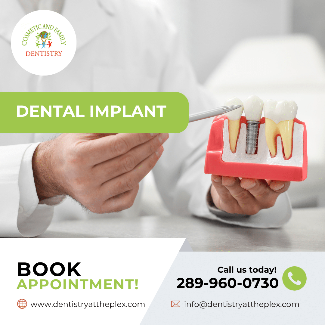Dental Implant