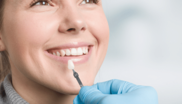 Porcelain-Veneers