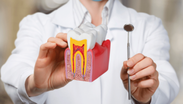 Root-Canals-Treatment