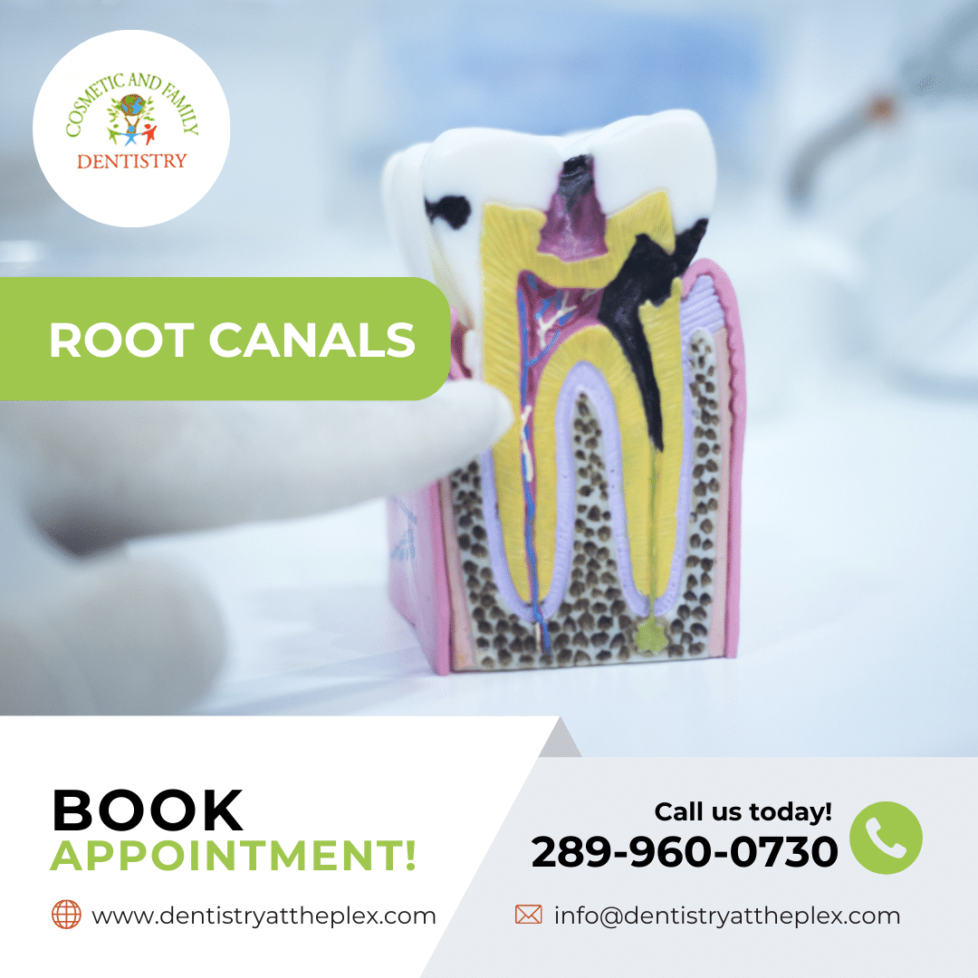 Root Canals