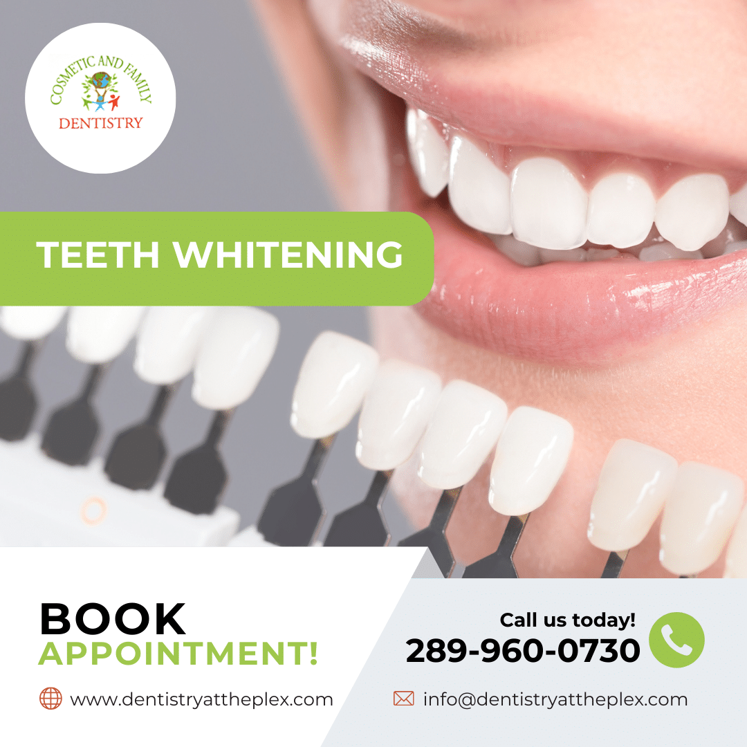 Teeth Whitening