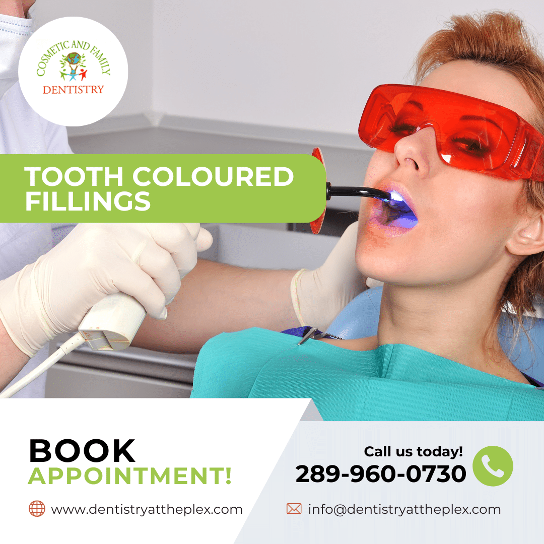 Tooth Coloured Fillings