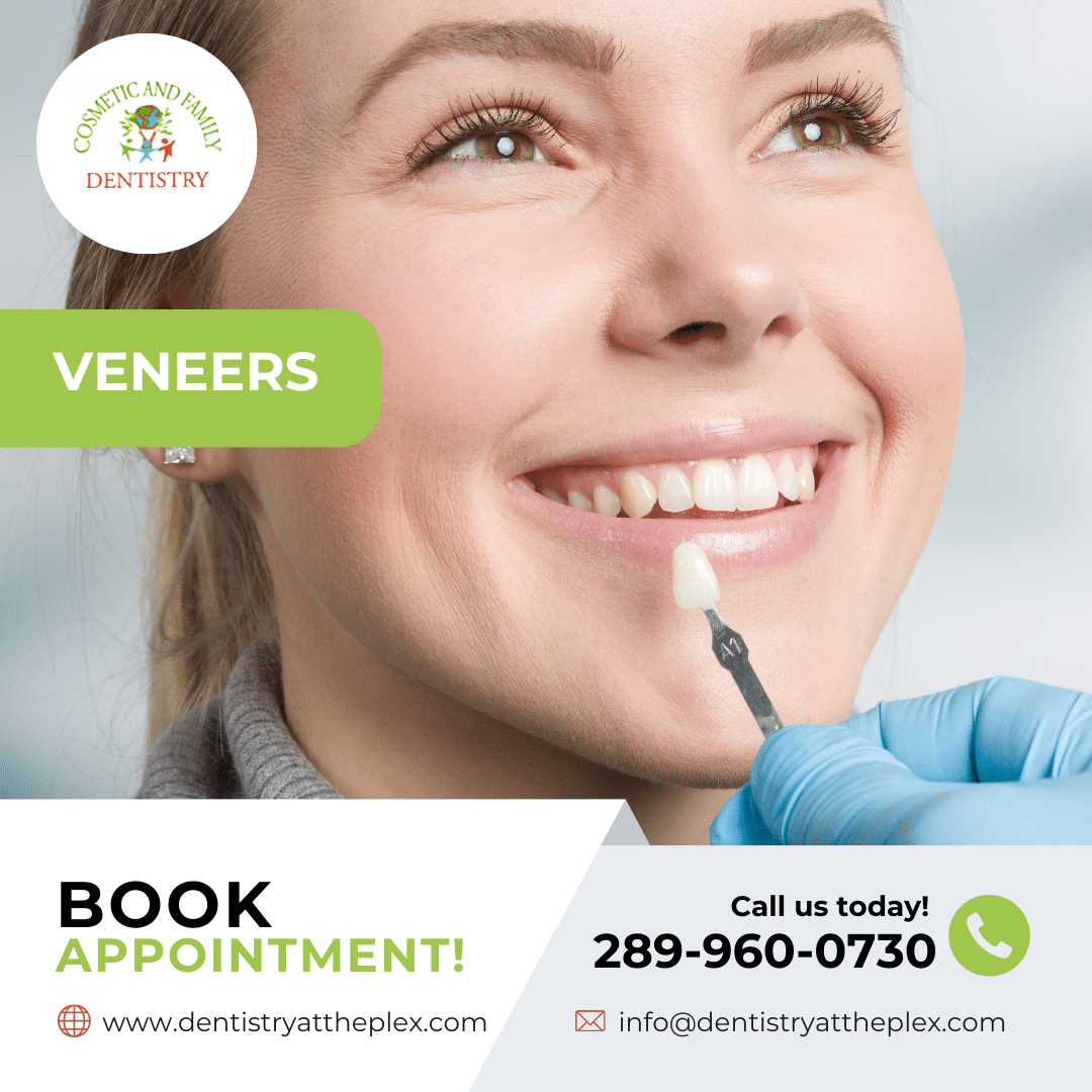Veneers