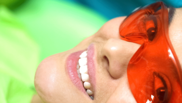 fracturedchipped tooth